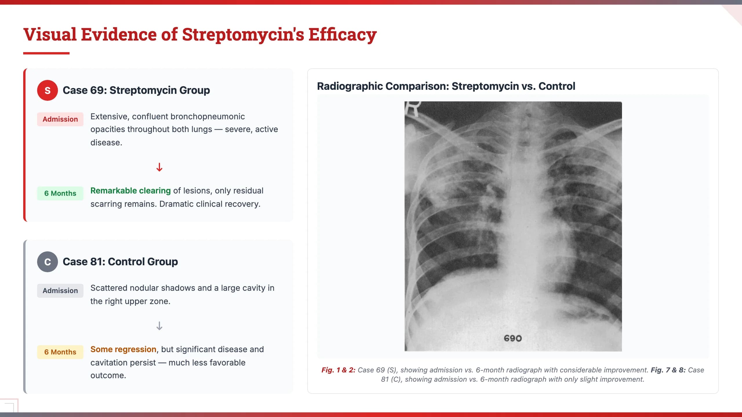 MIT Tech Red Engineering & Academic Presentation Template — Slide 6